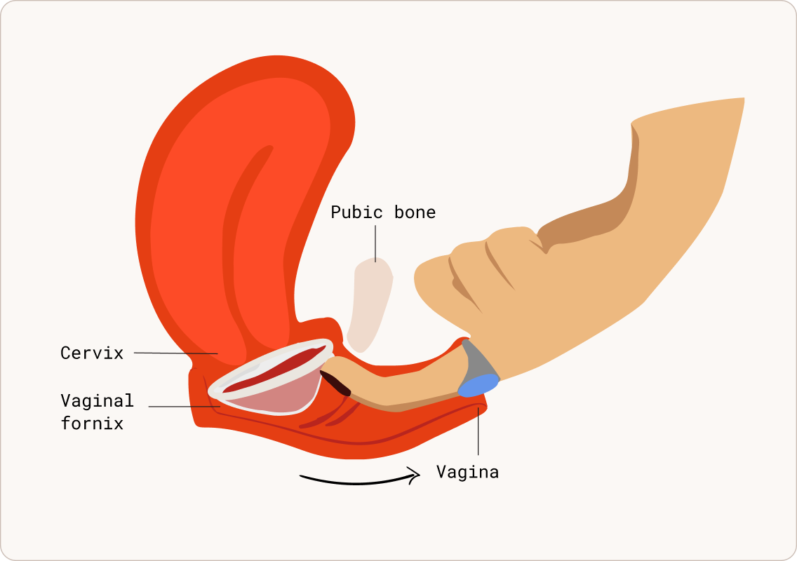 Bear down for easier removal